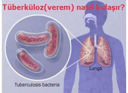 Sorubak Bilgi